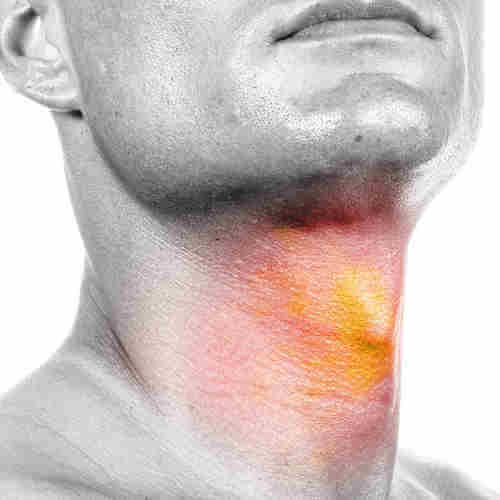 Head & Neck Surgeon in Ahmedabad