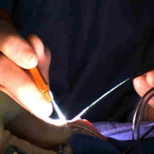 TLM Surgery in Ahmedabad