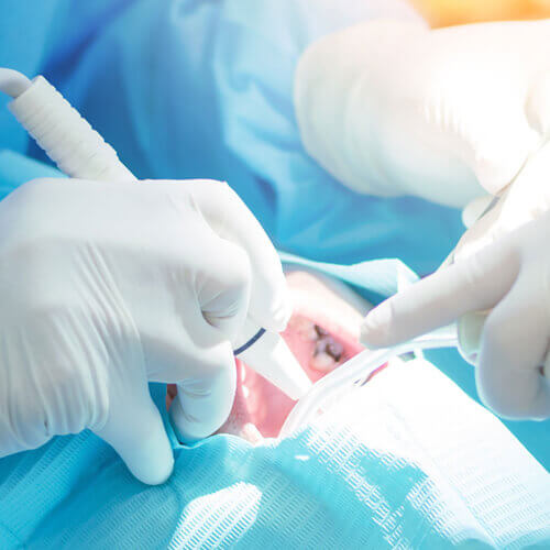 Minimally Invasive Laser Surgeon in Ahmedabad